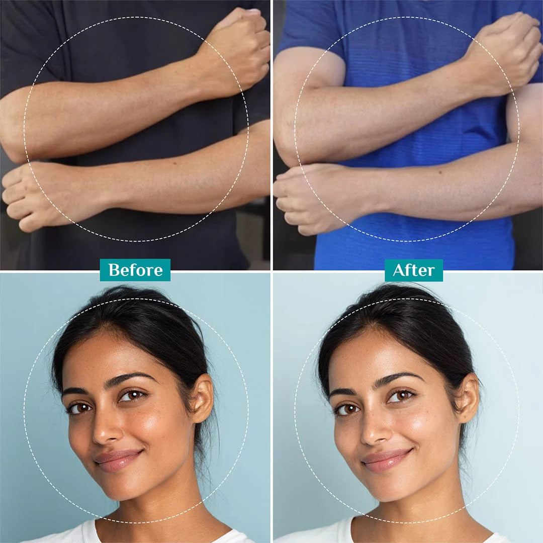 Pilgrim peeling solution